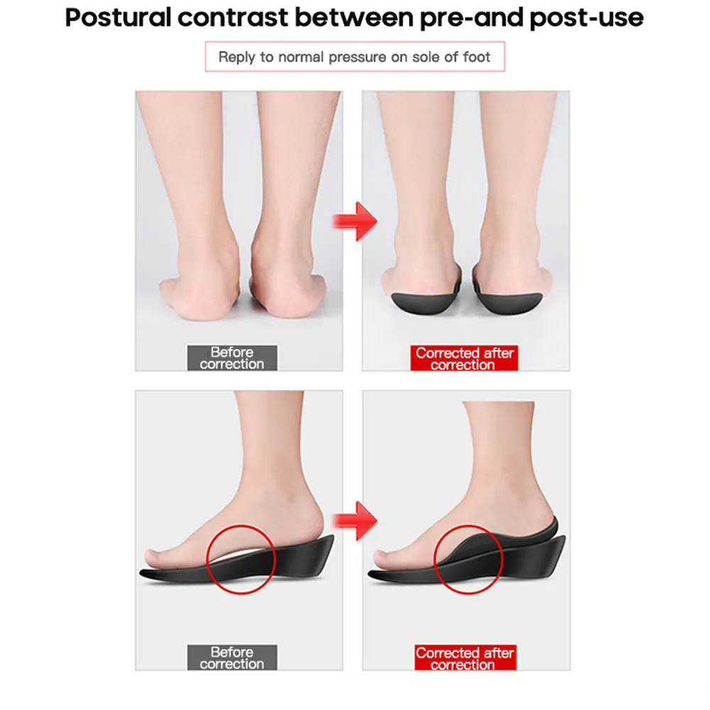 Set of 2 Pairs Feet Insoles Arch Supports Orthotics Inserts Flat Foot Orthopaedic Insoles for EU40-45
